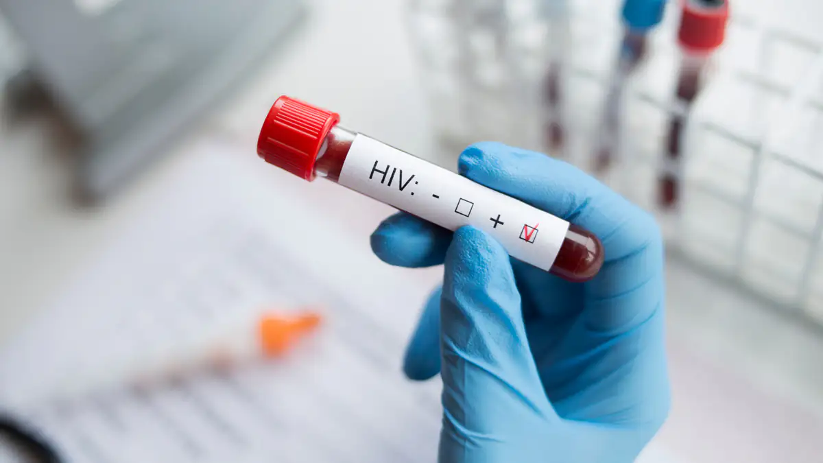 Gefährliche neue HIV-Variante in den Niederlanden entdeckt