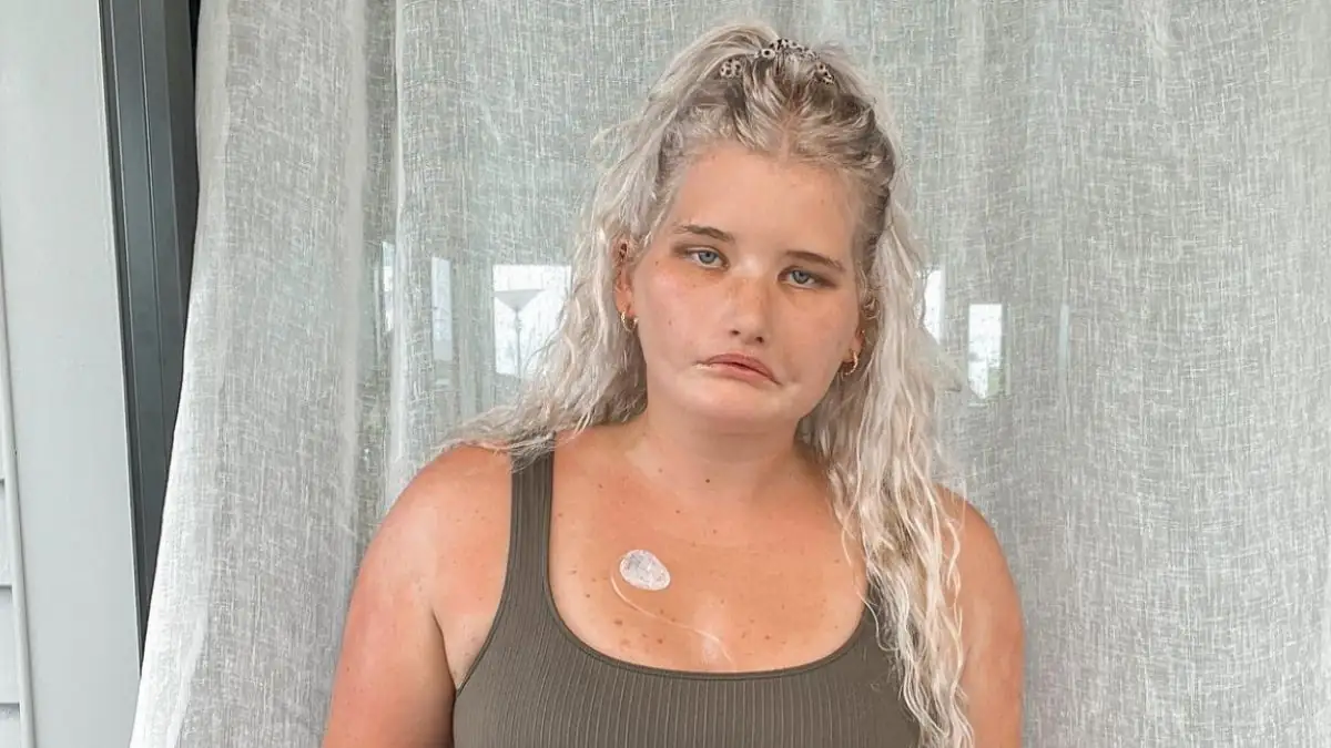 „Resting Bitch Face“: Frau ohne Lachen bekommt Modelvertrag