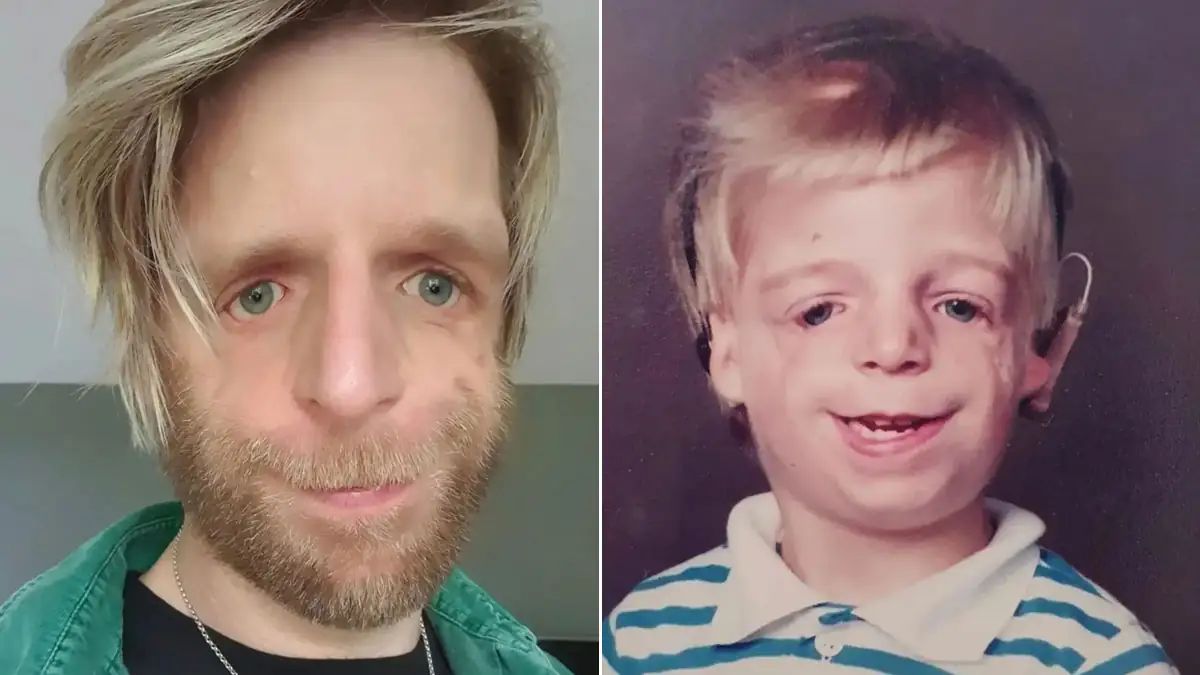 Weil er zu „hässlich“ ist: Eltern lassen ihr Baby in Klinik zurück