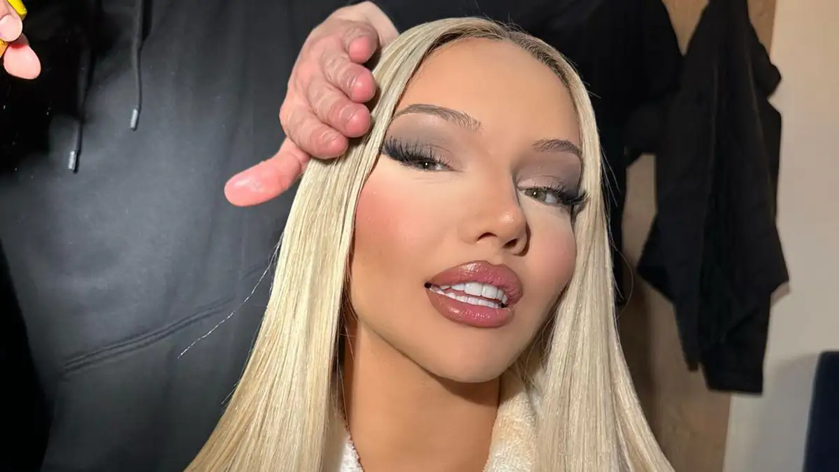 Shirin David: So sah sie vor ihren Beauty-OPs aus