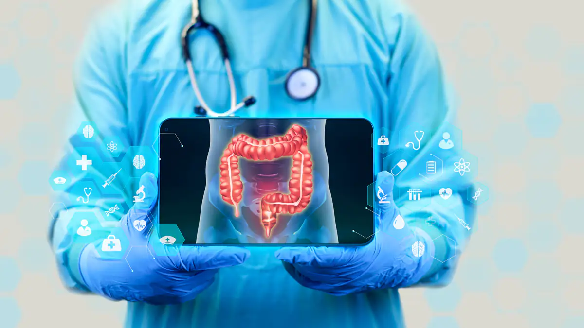 Forscher warnen: Beliebtes Lebensmittel kann Risiko für Darmkrebs erhöhen