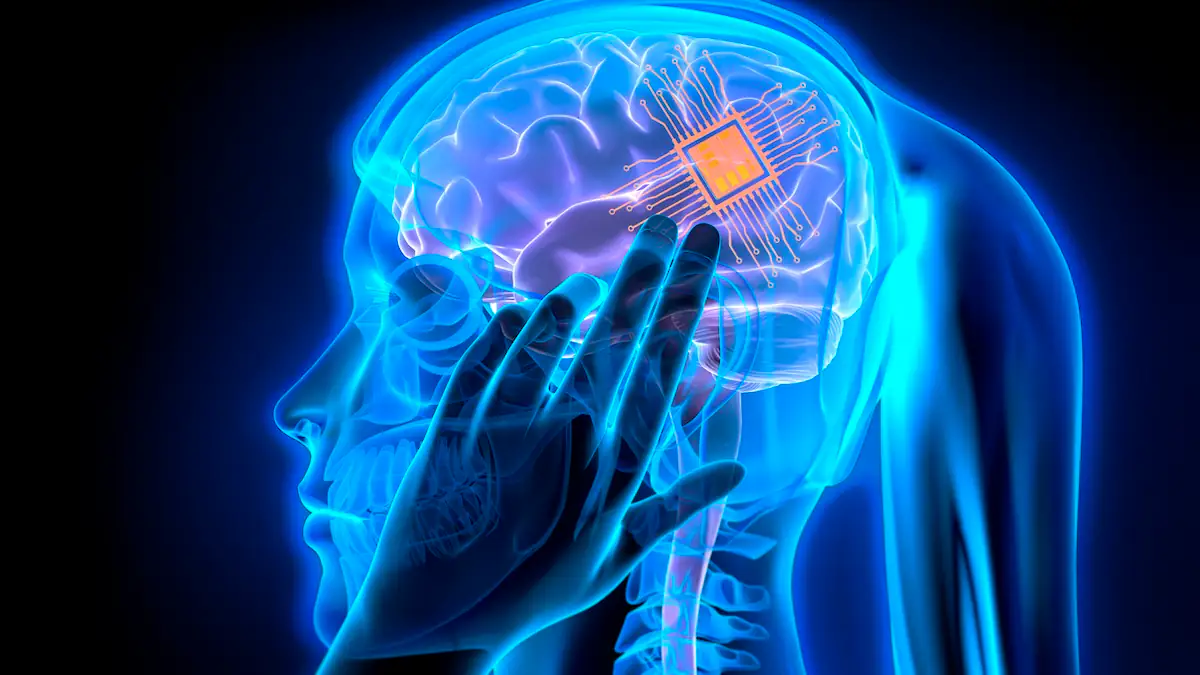 Wie in Sci-Fi-Filmen: KI-Implantat kann Gedanken lesen