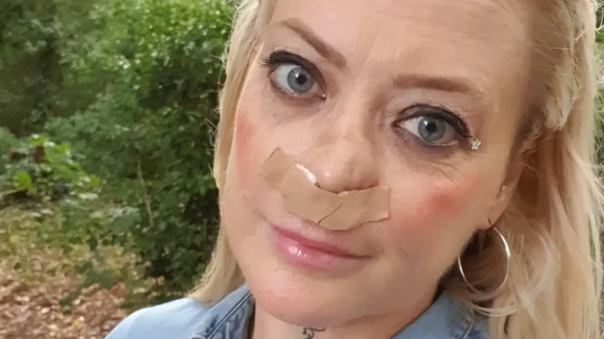 Nach günstiger Zahn-OP in der Türkei: Frau muss sich Zähne selbst einkleben und ist entstellt