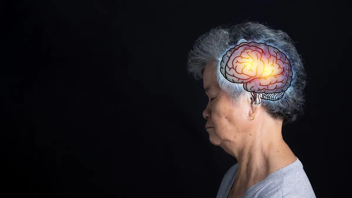 Symbolbild Alzheimer: Frau in höherem Alter mit einem Gehirn-Symbol auf dem Kopf