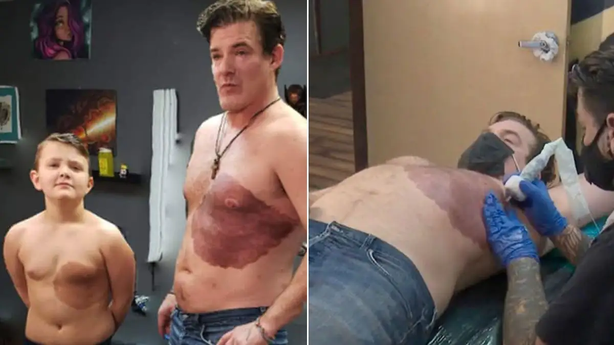Aus Liebe zum Sohn: Vater bekommt das gleiche Muttermal als Tattoo