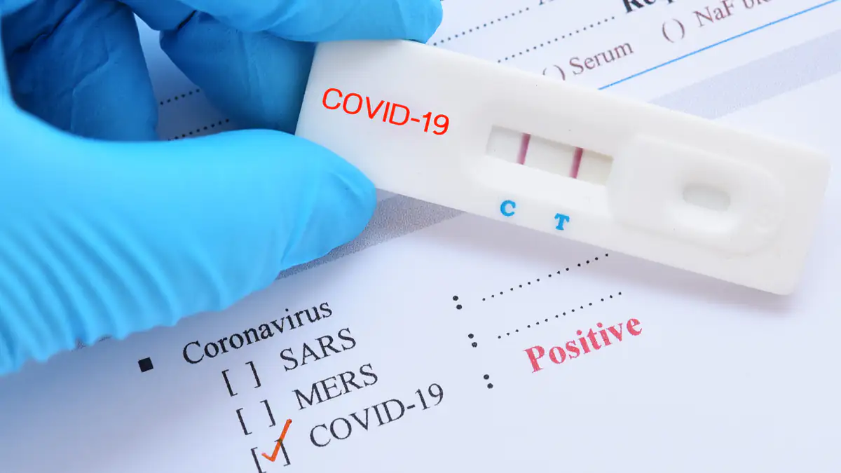 Ab 1. Juli: So viel sollen Coronatests bald kosten