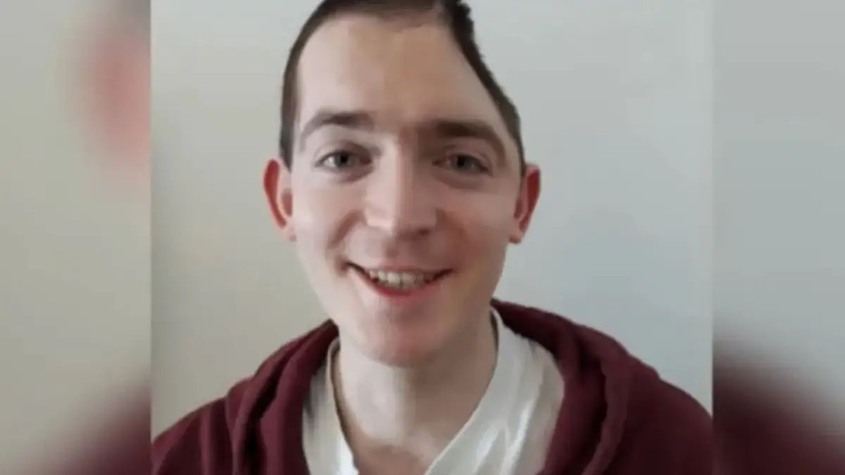 Nach Betriebsparty: Brite verliert halben Kopf