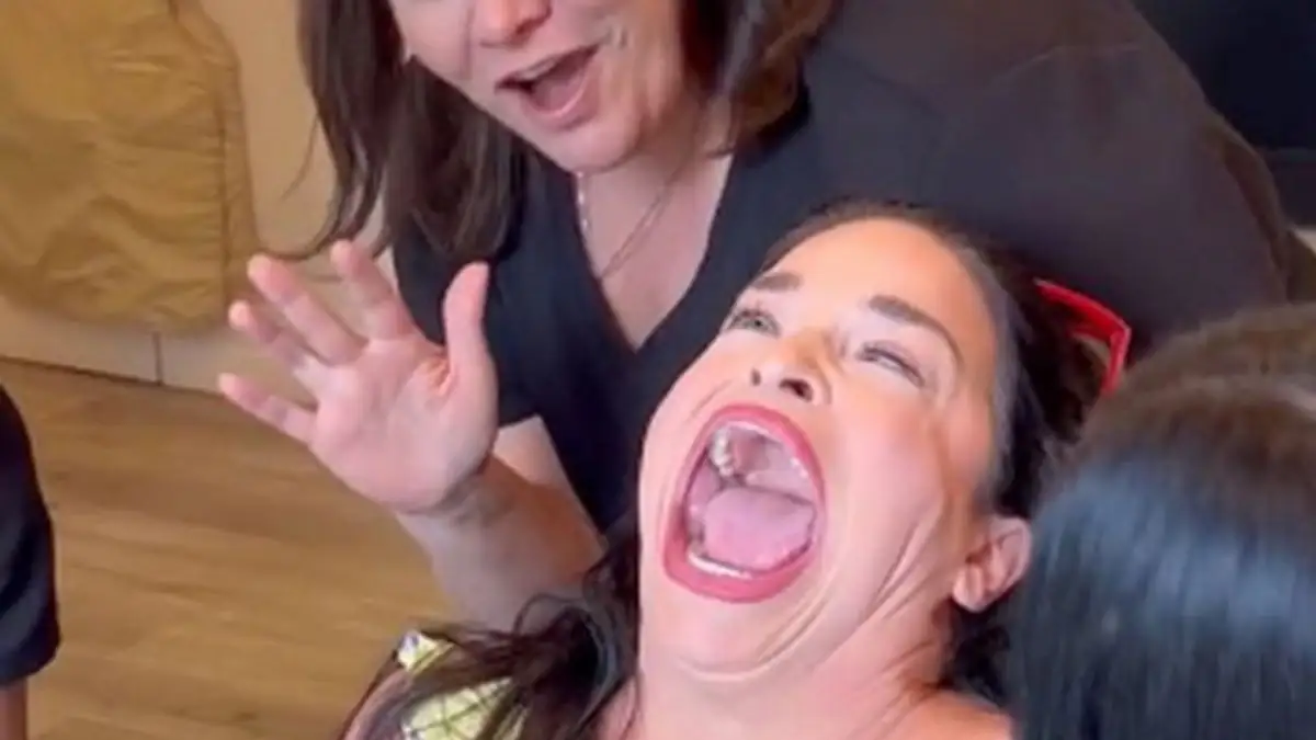 Frau mit dem größten Mund der Welt berichtet von bizarrem Zahnarzt-Besuch