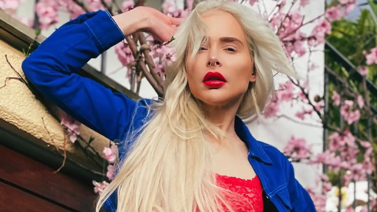 Theresia Fischer verrät, wie viel ihre Beinverlängerung gekostet hat