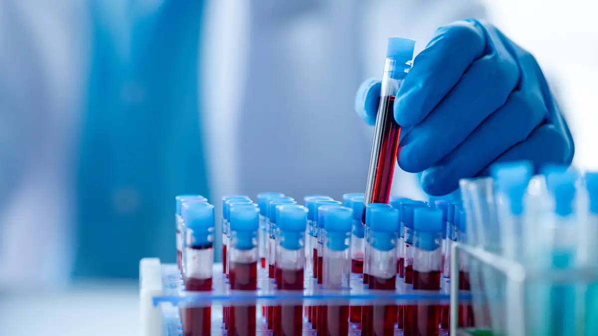 Forscher warnen: Diese Blutgruppe bringt ein erhöhtes Gesundheitsrisiko mit sich