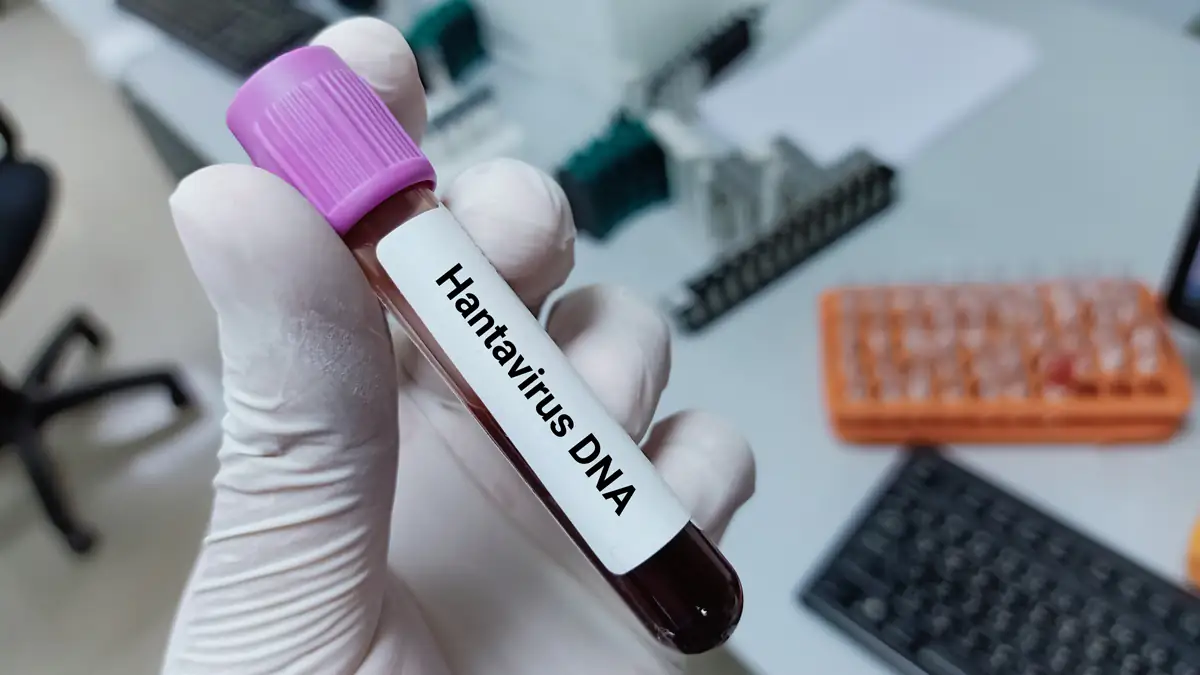 Warnung vor Hantavirus: Infektion droht bei Gartenarbeit