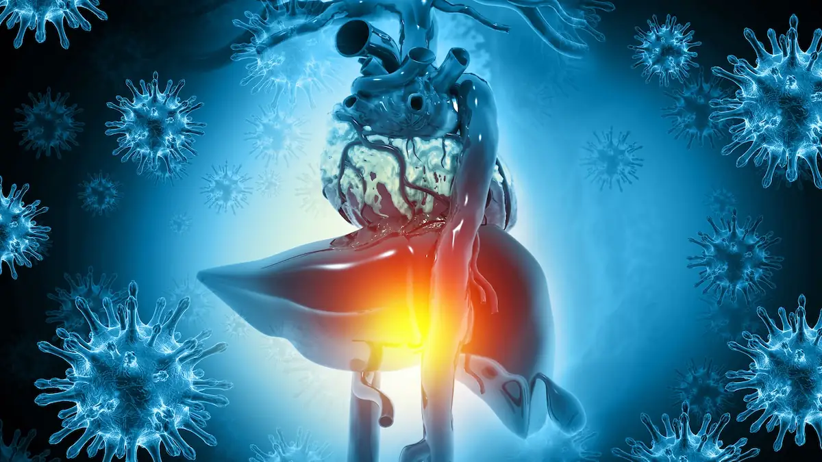 Fettleber Symbolbild: 3D-Illustration von einer geschädigten Leber