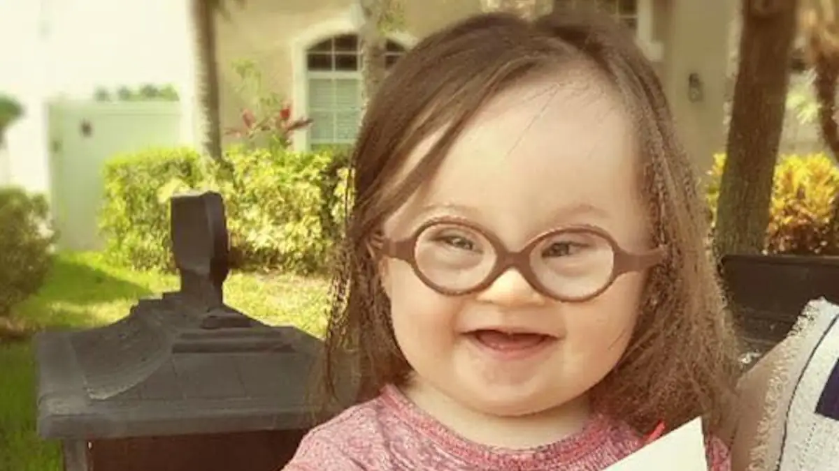 Trisomie 21: Kind mit Down Syndrom