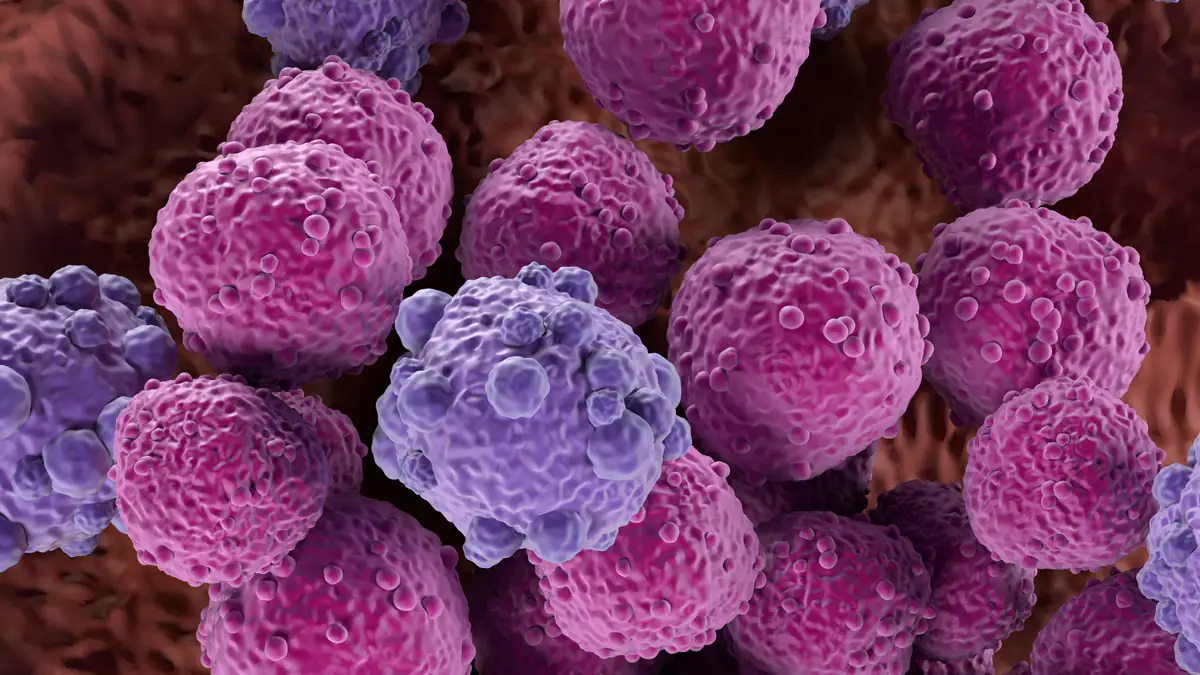 Krebs im Stadium vier: Junge Frau warnt vor Symptomen, die sie monatelang ignorierte