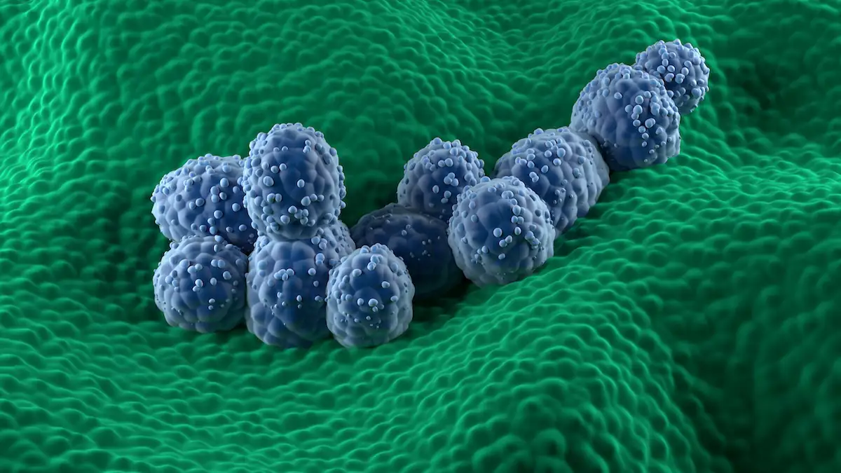 Verstecktes Krebsrisiko in vielen Lebensmitteln: Forscher entdecken Zusammenhang